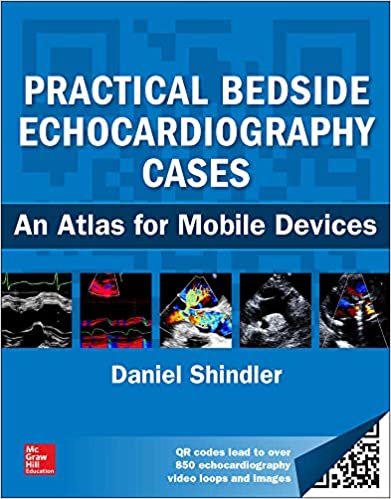 Practical Bedside Echocardiography Cases