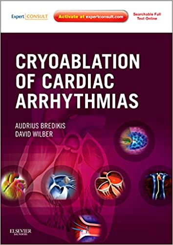 Cryoablation of Cardiac Arrhythmias