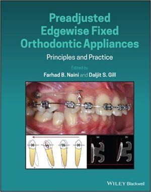Preadjusted Edgewise Fixed Orthodontic Appliances Principles and Practice