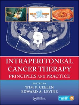 Intraperitoneal Cancer Therapy Principles and Practice