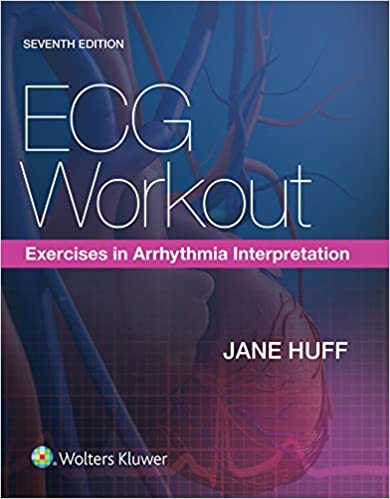 ECG Workout Exercises in Arrhythmia Interpretation 7th Ed