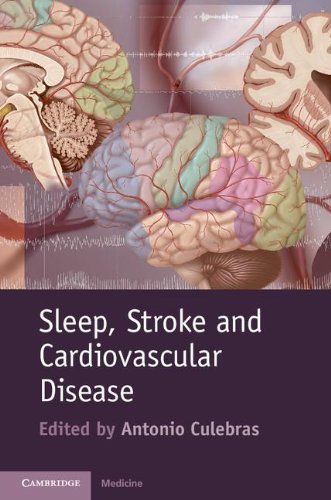 Sleep Stroke and Cardiovascular Disease