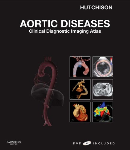 Aortic Diseases Clinical Diagnostic Imaging Atlas