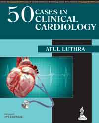 50 Cases in Clinical Cardiology A Problem Solving Approach