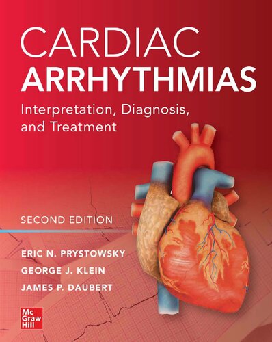 Cardiac Arrhythmias Interpretation Diagnosis and Treatment 2nd Ed
