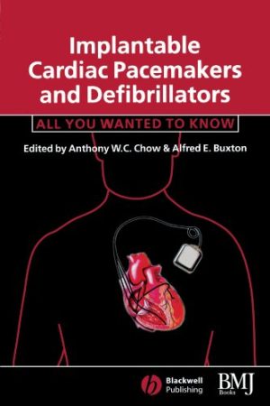 Implantable Cardiac Pacemakers and Defibrillators All You Wanted to Know