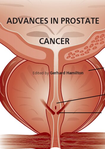 Advances in Prostate Cancer